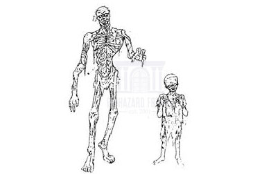 Enfant zombie